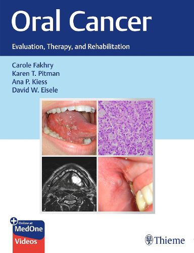 Cover image for Oral Cancer: Evaluation, Therapy, and Rehabilitation