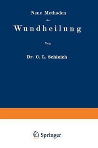 Cover image for Neue Methoden Der Wundheilung: Ihre Bedingungen Und Vereinfachung Fur Die Praxis