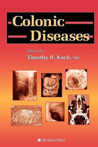 Cover image for Colonic Diseases