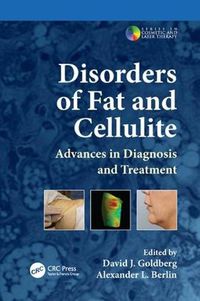 Cover image for Disorders of Fat and Cellulite: Advances in Diagnosis and Treatment