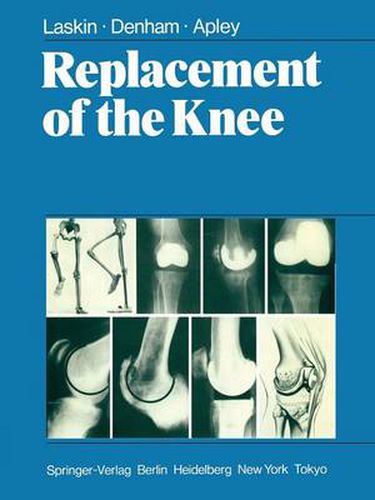 Cover image for Replacement of the Knee