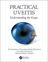 Cover image for Practical Uveitis: Understanding the Grape