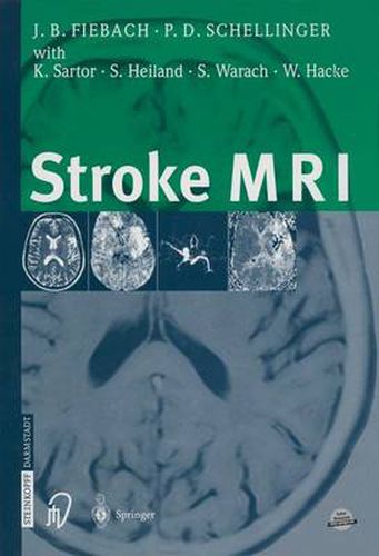 Cover image for Stroke MRI