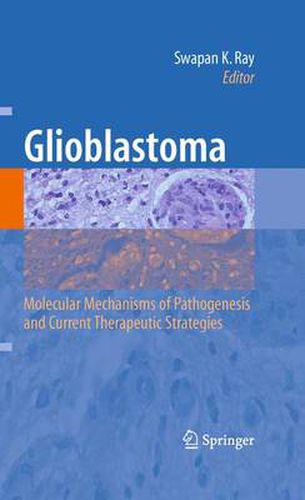 Cover image for Glioblastoma:: Molecular Mechanisms of Pathogenesis and Current Therapeutic Strategies