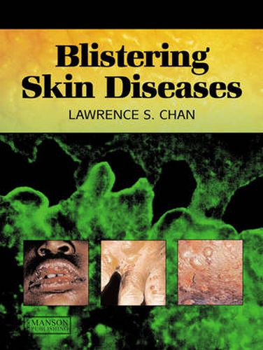 Cover image for Blistering Skin Diseases