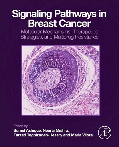 Cover image for Signaling Pathways in Breast Cancer