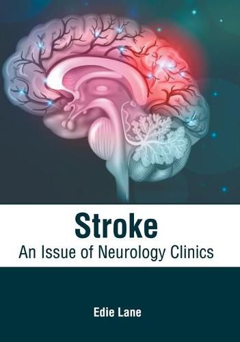 Cover image for Stroke: An Issue of Neurology Clinics