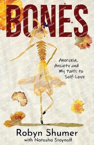 Cover image for Bones