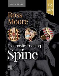 Cover image for Diagnostic Imaging: Spine