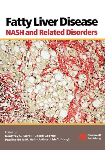 Fatty Liver Disease: NASH and Related Disorders