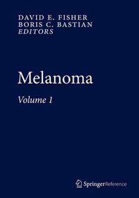 Cover image for Melanoma