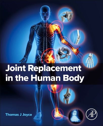 Cover image for Joint Replacement in the Human Body