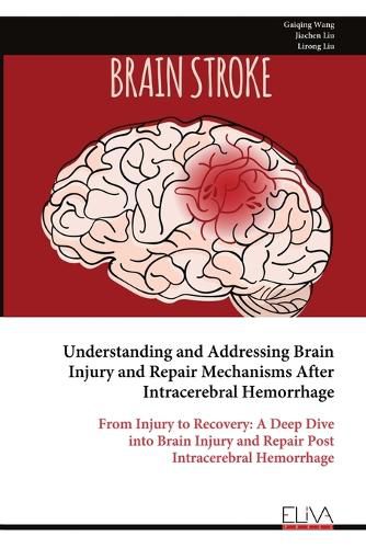 Cover image for Understanding and Addressing Brain Injury and Repair Mechanisms After Intracerebral Hemorrhage