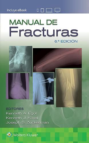 Cover image for Manual de fracturas