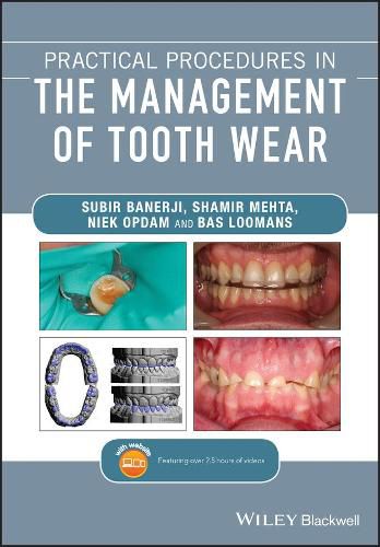 Cover image for Practical Procedures in the Management of Tooth Wear