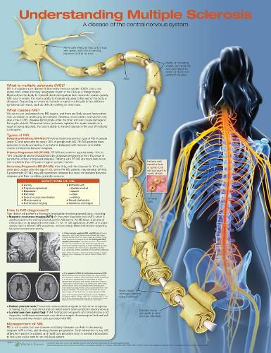 Cover image for Understanding Multiple Sclerosis Anatomical Chart