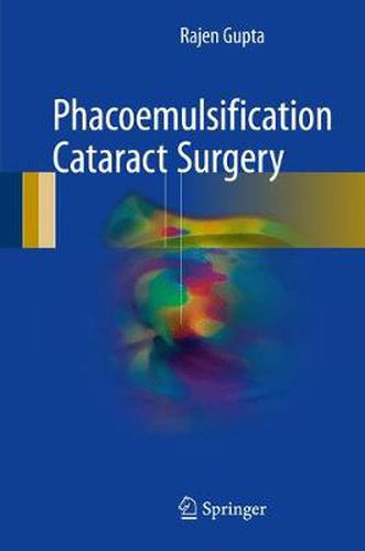 Cover image for Phacoemulsification Cataract Surgery