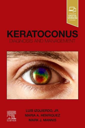 Cover image for Keratoconus: Diagnosis and Management