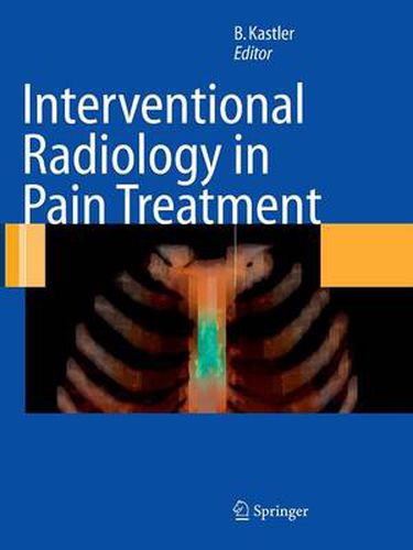 Interventional Radiology in Pain Treatment