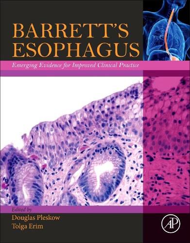 Cover image for Barrett's Esophagus: Emerging Evidence for Improved Clinical Practice