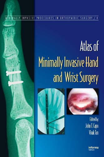 Cover image for Atlas of Minimally Invasive Hand and Wrist Surgery