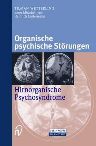 Cover image for Organische Psychische Stoerungen: Hirnorganische Psychosyndrome