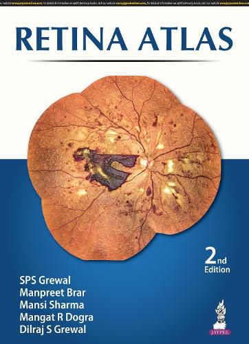 Cover image for Retina Atlas