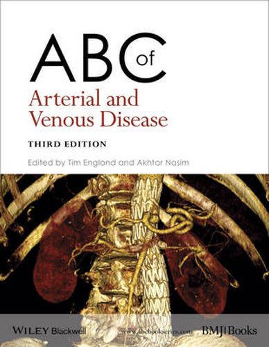 Cover image for ABC of Arterial and Venous Disease 3e