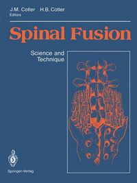 Cover image for Spinal Fusion: Science and Technique