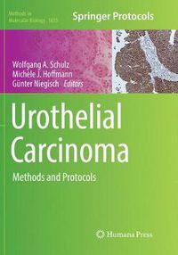 Cover image for Urothelial Carcinoma: Methods and Protocols