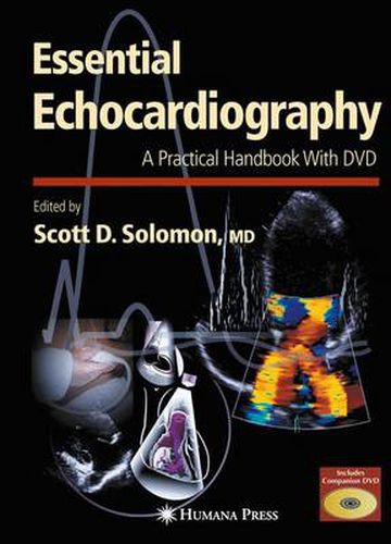 Cover image for Essential Echocardiography: A Practical Guide With DVD