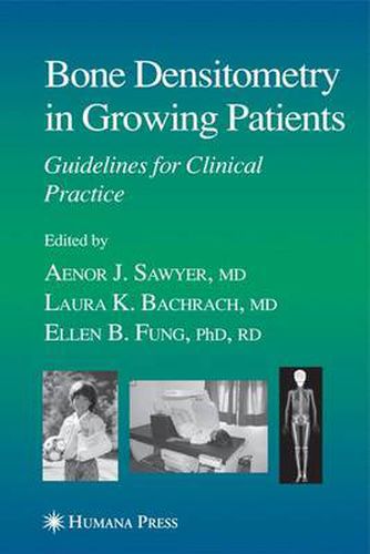 Cover image for Bone Densitometry in Growing Patients