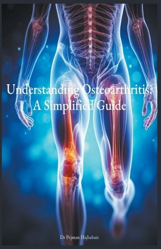 Cover image for Understanding Osteoarthritis