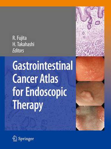 Cover image for Gastrointestinal Cancer Atlas for Endoscopic Therapy