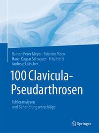 Cover image for 100 Clavicula-Pseudarthrosen: Fehleranalysen und Behandlungsvorschlage