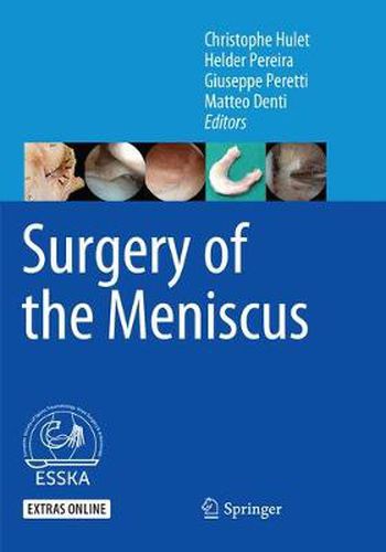 Cover image for Surgery of the Meniscus