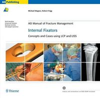 Cover image for AO Manual of Fracture Management - Internal Fixators