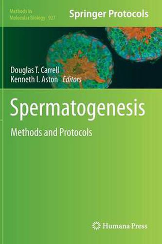 Cover image for Spermatogenesis: Methods and Protocols