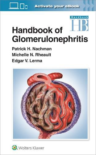 Cover image for Handbook of Glomerulonephritis