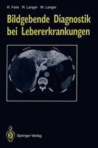 Cover image for Bildgebende Diagnostik bei Lebererkrankungen