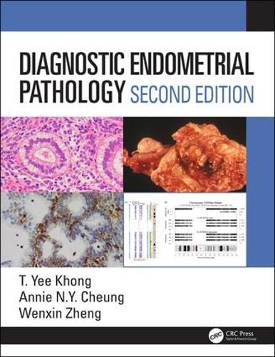 Diagnostic Endometrial Pathology