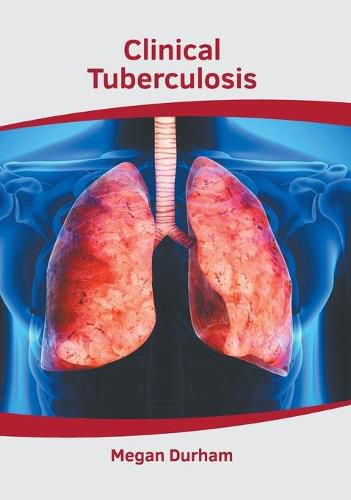 Cover image for Clinical Tuberculosis