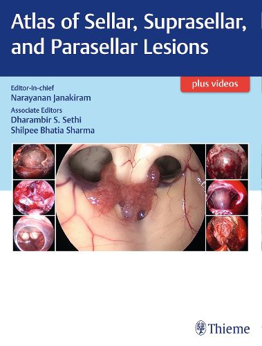 Cover image for Atlas of Sellar, Suprasellar, and Parasellar Lesions