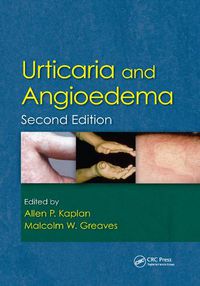 Cover image for Urticaria and Angioedema