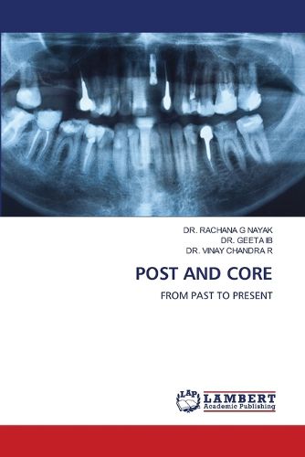 Cover image for Post and Core