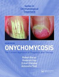 Cover image for Onychomycosis: The Current Approach to Diagnosis and Therapy