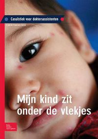 Cover image for Mijn Kind Zit Onder de Vlekjes: Casuistiek Voor Doktersassistenten