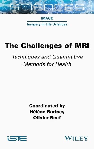 Cover image for The Challenges of MRI