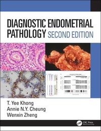 Cover image for Diagnostic Endometrial Pathology