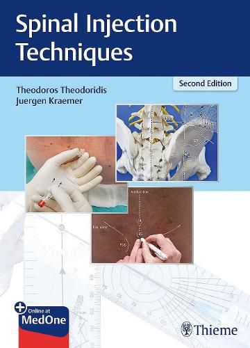 Cover image for Spinal Injection Techniques